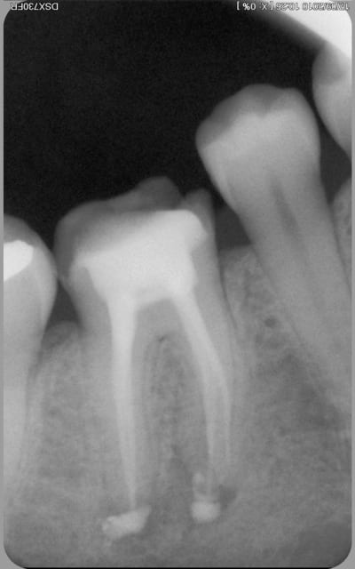 Fi1 vxhltt - Eugenol