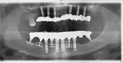 Fin uv5lwy - Eugenol