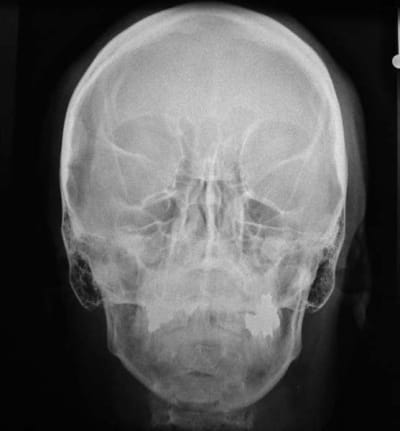 Face op1hnm - Eugenol