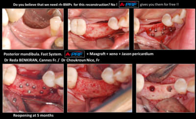 Fast 3 zmjmds - Eugenol