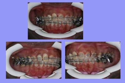 Fin 1 jm2knv - Eugenol