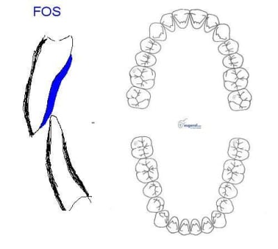 Fos arcade adhbzg - Eugenol