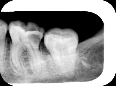 Gwav qsrxh5 - Eugenol