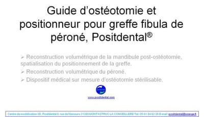 Guide de coupes pour greffe fibula  p ron    positdental 001 xy4pqd - Eugenol