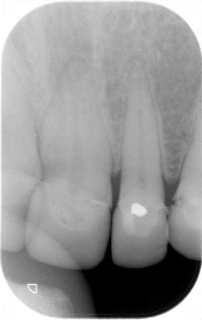 Hd12041601 v3s0js - Eugenol