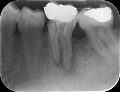 Hafid 316 20111219 19 03 07 oyyjcg - Eugenol