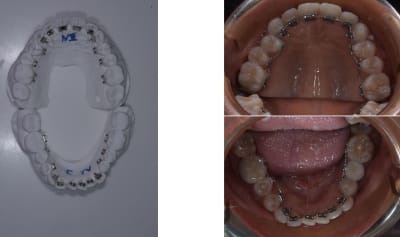 Hautbas cm2kuc - Eugenol