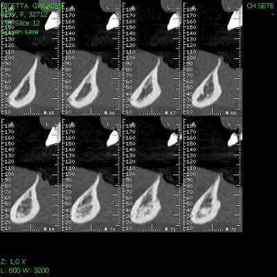 Img11 tj0jj8 - Eugenol