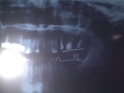 Imgp0229 ee1sgb - Eugenol