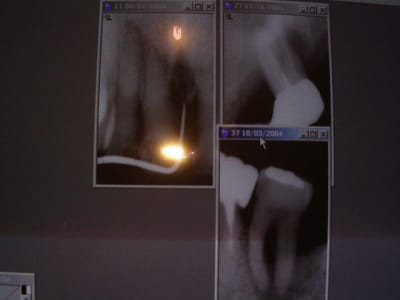Imgp0237 sv1ut6 - Eugenol