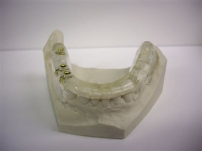 Imgp1155 gkkxkg - Eugenol