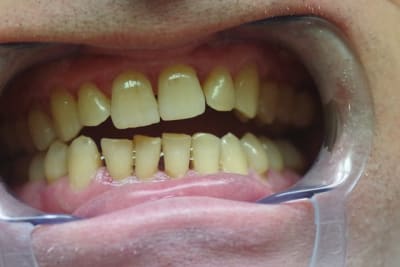 Imgp1346 mfqfqt - Eugenol