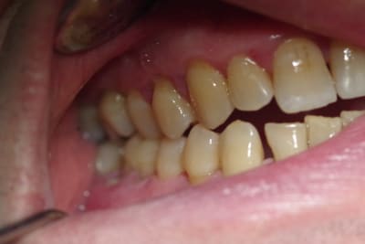 Imgp1352 pldnji - Eugenol