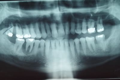 Imgp1360 olk8qa - Eugenol