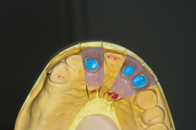 Imgp3937 gruir2 - Eugenol