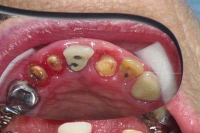 Imgp3938 j2uuax - Eugenol