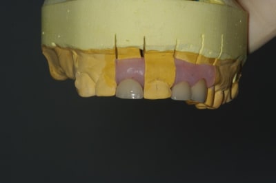 Imgp3944 gflgne - Eugenol