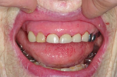 Imgp3952 pyjrzx - Eugenol