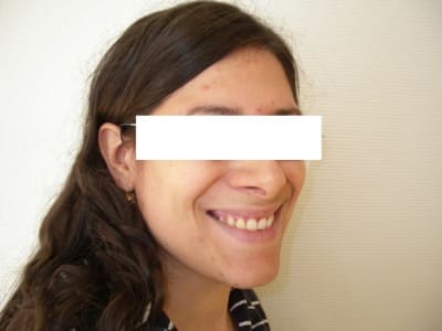 Imgp8144 ze6la6 - Eugenol