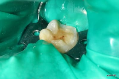 Img 0030 zhcmtt - Eugenol