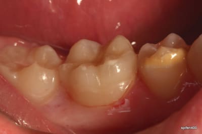 Img 0031 rxmlqp - Eugenol