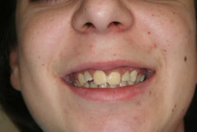 Img 0042 acdvwi - Eugenol