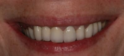 Img 0081 nwgm2l - Eugenol