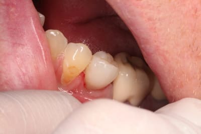 Img 0082 i5zgqc - Eugenol