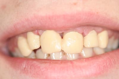 Img 0082 zjffjk - Eugenol