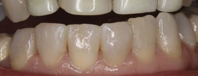 Img 0114   version 2 cr4wfn - Eugenol