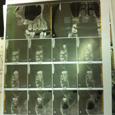 Img 0122 ga6tkm - Eugenol