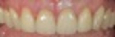 Img 0138  2  thumb i8iler - Eugenol