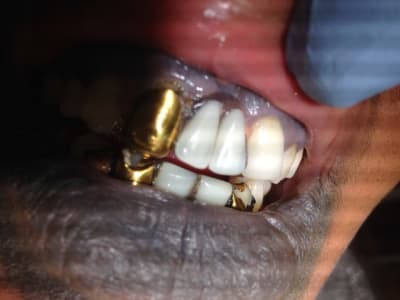Img 0178 uoinql - Eugenol