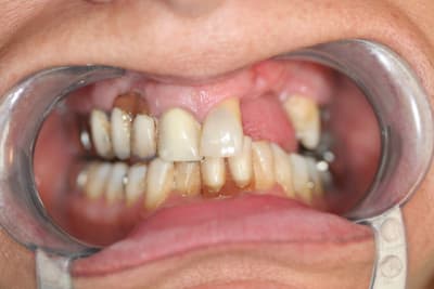 Img 0226 iaoqtw - Eugenol