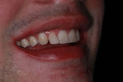 Img 0267 kdujon - Eugenol