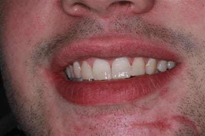 Img 0269 slpie2 - Eugenol