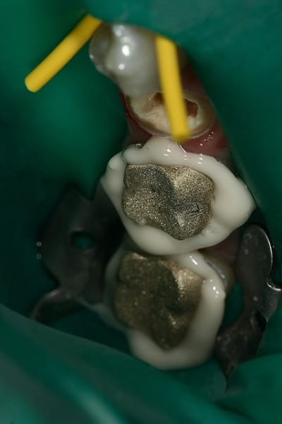 Img 0282 hc0bwc - Eugenol