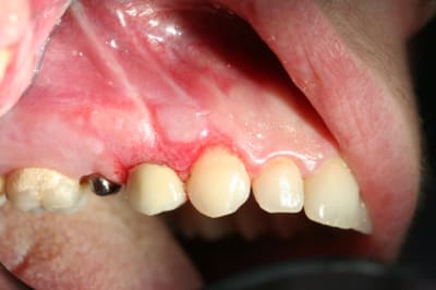Img 0401 fllj2h - Eugenol