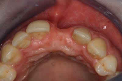 Img 0425 wv8ujs - Eugenol