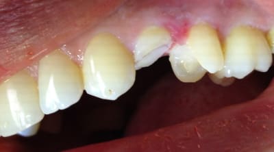 Img 0428 nsvsgr - Eugenol