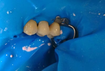 Img 0438 anqgdn - Eugenol