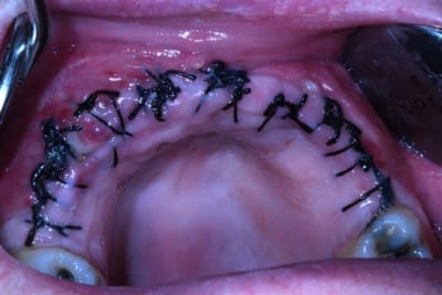 Img 0438 lqo6hu - Eugenol