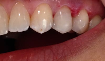 Img 0439 dpwwwb - Eugenol