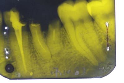 Img 0470 tai3y0 - Eugenol