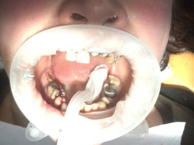 Img 0482 jposi8 - Eugenol