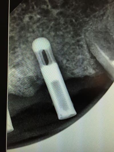 Img 0492 x4u51o - Eugenol