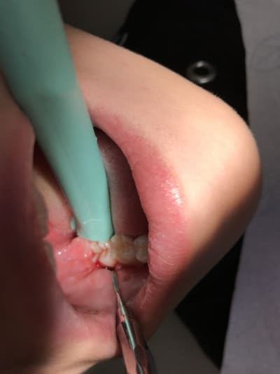 Img 0516 rjjuwj - Eugenol