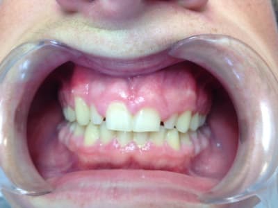 Img 0611 vubxnv - Eugenol