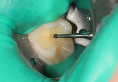 Img 0623 juf6pl - Eugenol