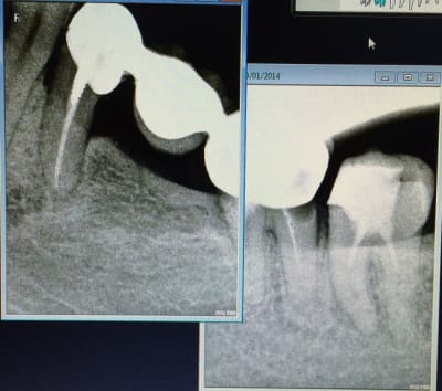 Img 0626 bweooi - Eugenol